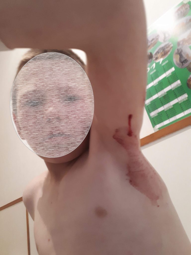 9 eves gyerek aldozat (3)